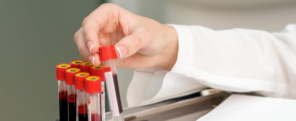 Cancer what is liquid biopsy Where to do it