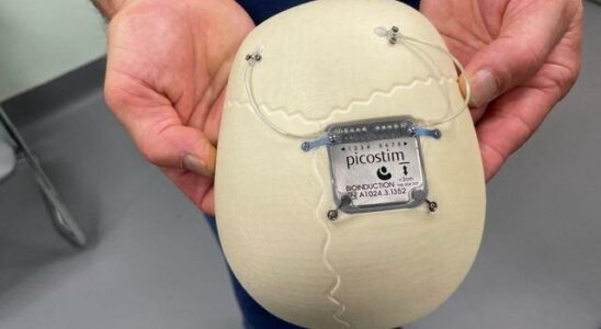 For the first time in the world an epilepsy device