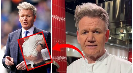 Gordon Ramsay in serious accident shows the horror damage