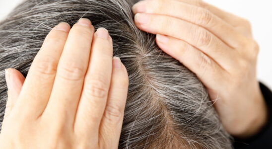 Heres What to Eat to Prevent Gray Hair