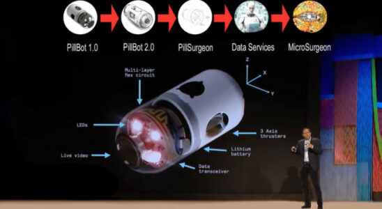 Thanks to the swallowable Pillbot endoscopy can be performed remotely