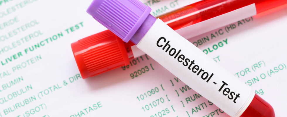 1721195007 Cholesterol level not to be exceeded after 60 years