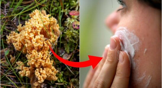 Common misunderstandings signs that you have fungus