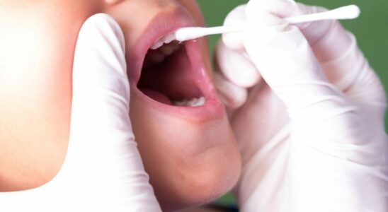 In January 2025 fluoride varnishes will be reimbursed from 1