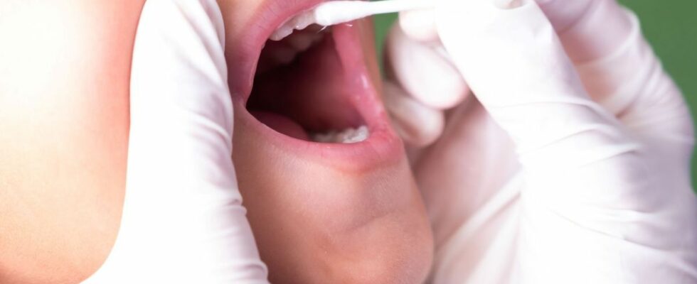 In January 2025 fluoride varnishes will be reimbursed from 1