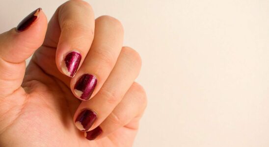 Stop Picking At Your Nail Polish Experts Explain The Dangers