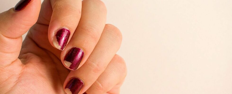 Stop Picking At Your Nail Polish Experts Explain The Dangers