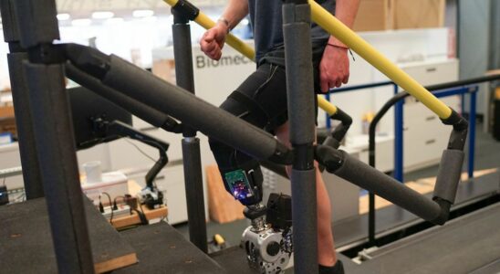 This bionic leg allows natural walking and transforms the lives