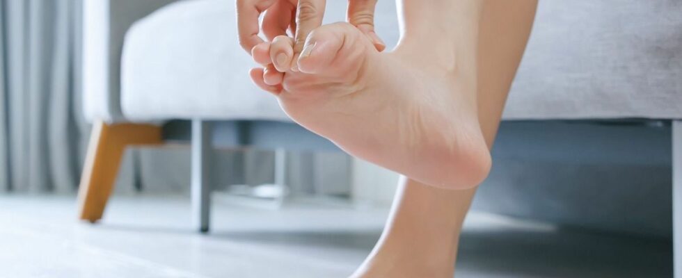 What is athletes foot that wreaks havoc in summer A