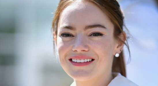 With her ultra puffed lips and XXL bob Emma Stone is