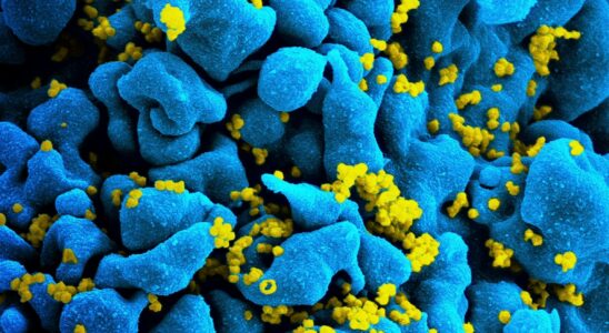 the method that allowed the cure of a seventh HIV