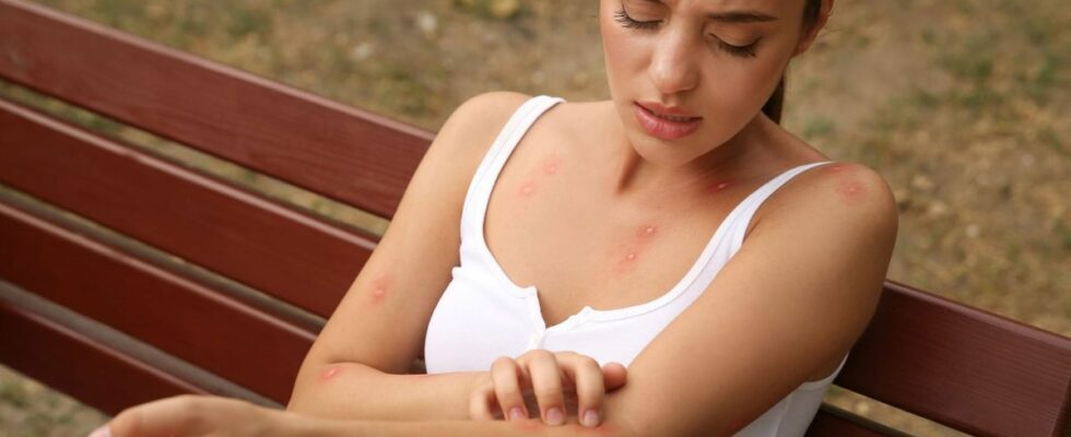 3 Signs to Look Out for After a Simple Mosquito