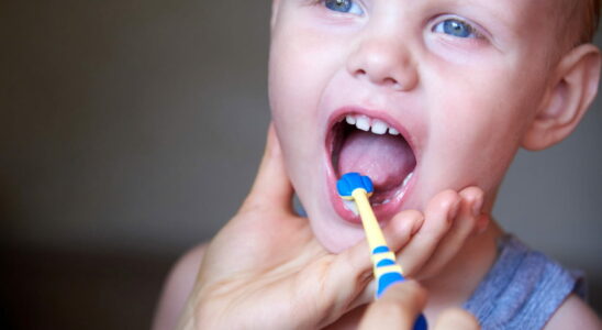 A dentists foolproof tips to get baby to accept brushing