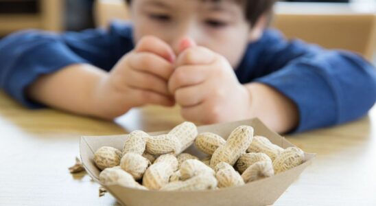 Australia launches gold standard treatment for peanut allergy in babies