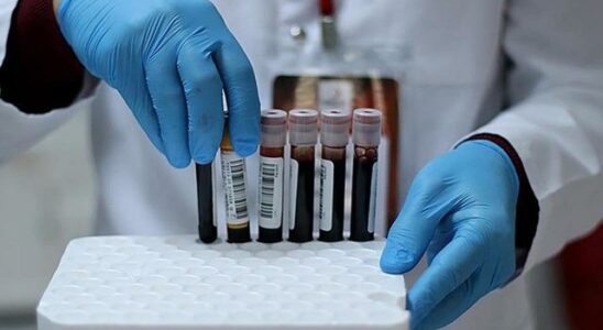 Can blood type change over time Scientists explained it as