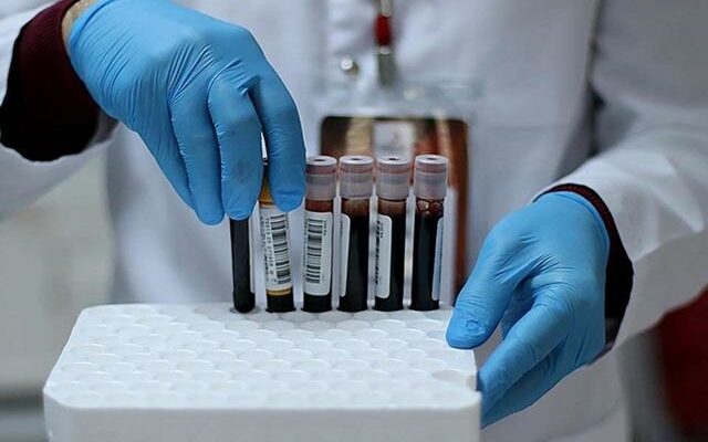 Can blood type change over time Scientists explained it as