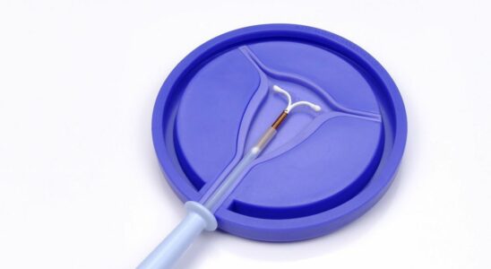 IUD and pain doctors are called upon to listen better