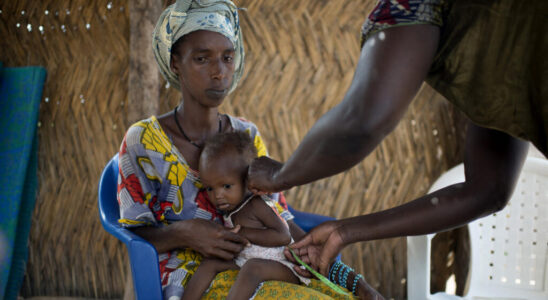 Mali Child malnutrition at its highest in 10 years warns