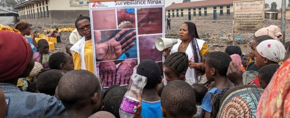 Mpox Central African Republic focuses on prevention after discovery of