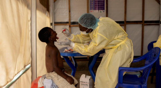 Mpox in the DRC a response plan of 49 million