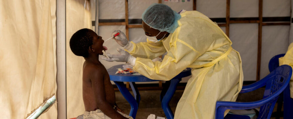 Mpox in the DRC a response plan of 49 million