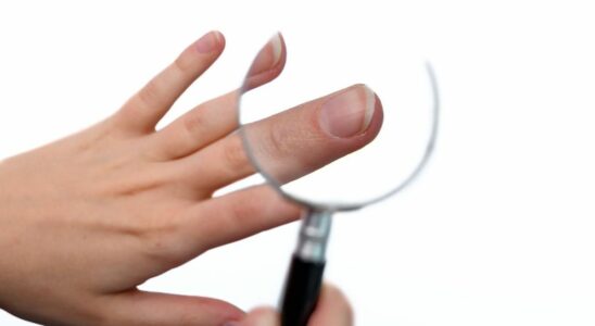 This Detail About Your Nails You Need to Check It