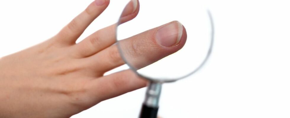 This Detail About Your Nails You Need to Check It