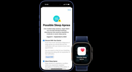 FDA Approves Apple Watch Sleep Apnea Feature