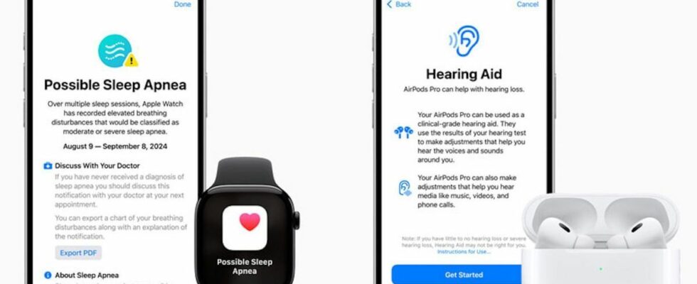 Sleep apnea the Apple Watch can now alert you to