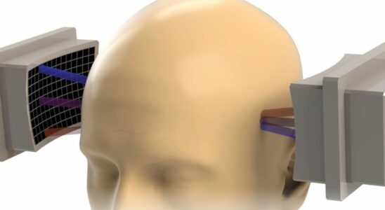 Ultrasound Headband Promises To Relieve Depression And Chronic Pain In